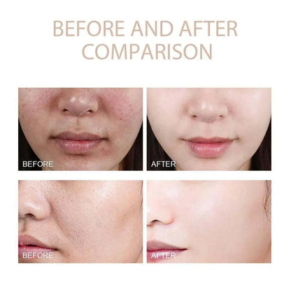 Dr. Melaxin Peel Shot®